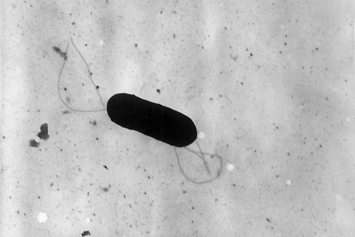 Российские ученые придумали новое средство от пищевых инфекций у беременных Российские ученые придумали новое средство от пищевых инфекций у беременных