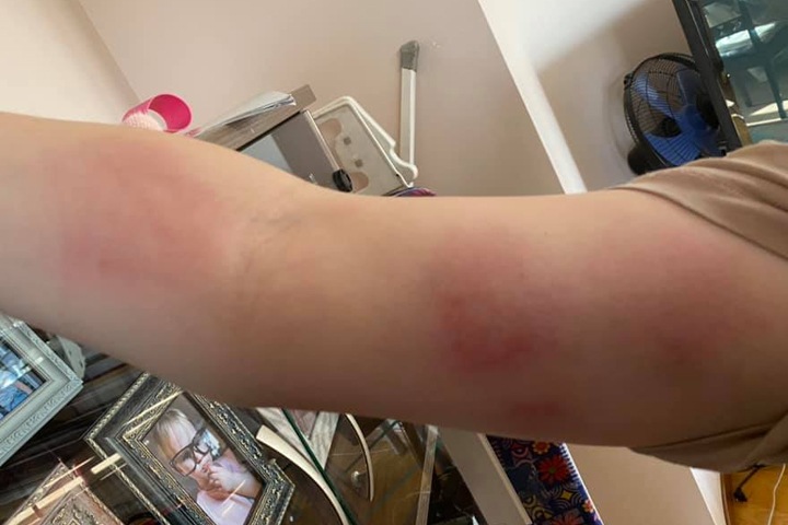 Оппозиционный кандидат в Госдуму из Приангарья рассказал об отравлении жены химвеществом