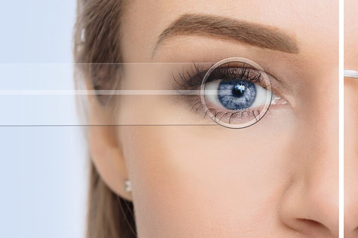 Как скорректировать зрение
