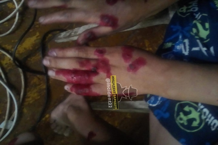 «Все в язвах»: опека забрала троих детей у семьи из Барнаула