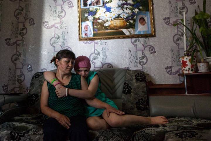 Дорогой эндопротез спасет юной сибирячке ногу Дорогой эндопротез спасет юной сибирячке ногу