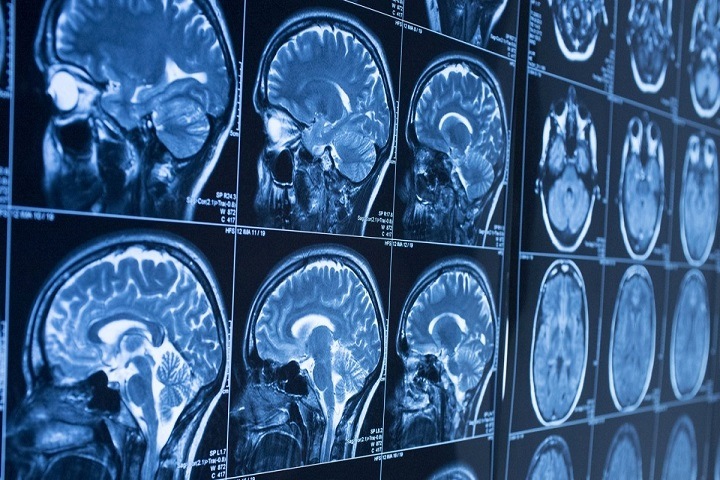 Томские ученые разработали новые препараты для диагностики рака Томские ученые разработали новые препараты для диагностики рака