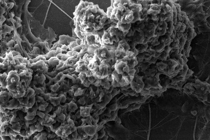 Ученые пересмотрели механизм образования артериальных тромбов. В нем участвуют клетки-зомби Ученые пересмотрели механизм образования артериальных тромбов. В нем участвуют клетки-зомби