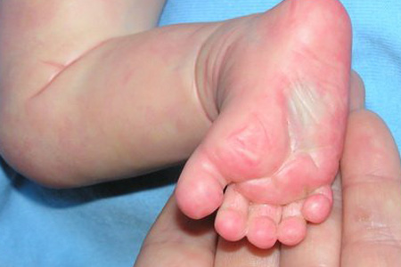 Новорожденный умер в перинатальном центре Читы 