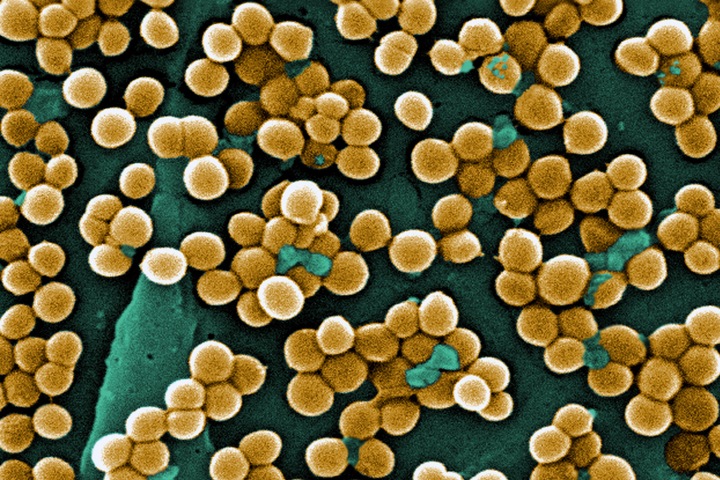 Ученые выяснили механизм устойчивости бактерии, которая вызывает пневмонию Ученые выяснили механизм устойчивости бактерии, которая вызывает пневмонию