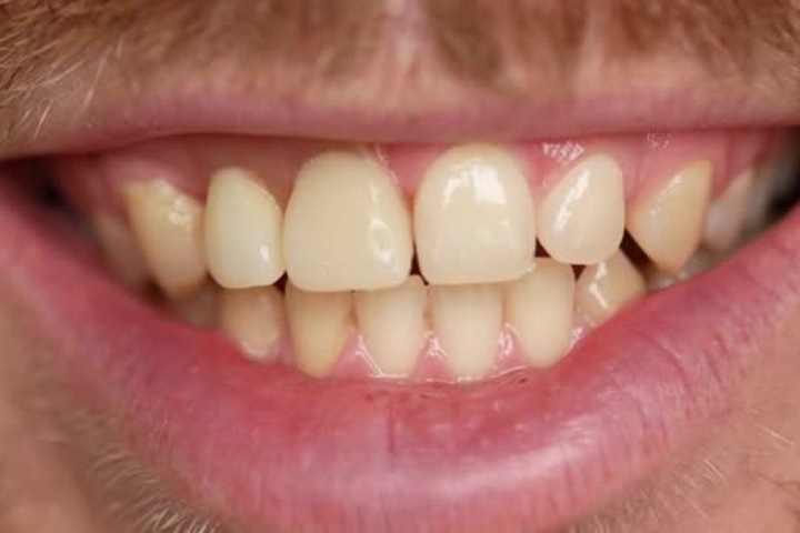 Укусивший полицейского за ногу омич отделался штрафом