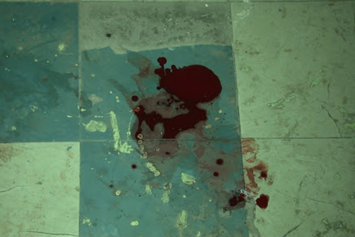 Избитого в Омске мужчину оштрафовали за нарушение режима самоизоляции Избитого в Омске мужчину оштрафовали за нарушение режима самоизоляции