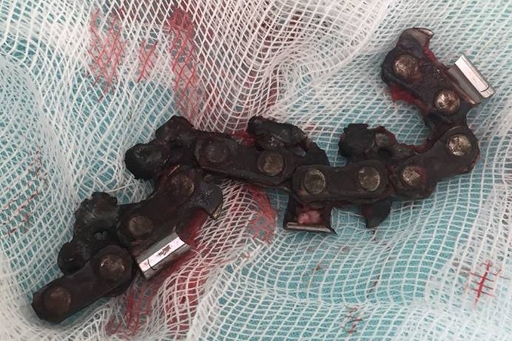 Пьяный подросток на Алтае напал на родственника с бензопилой