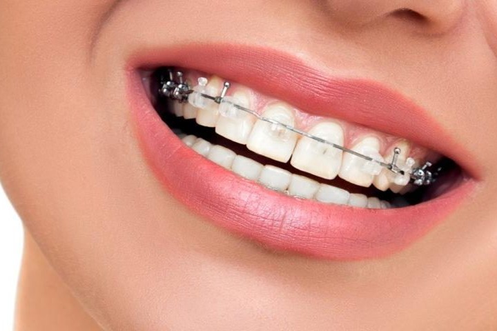 Кто определяет длительность лечения и можно ли на нее влиять?