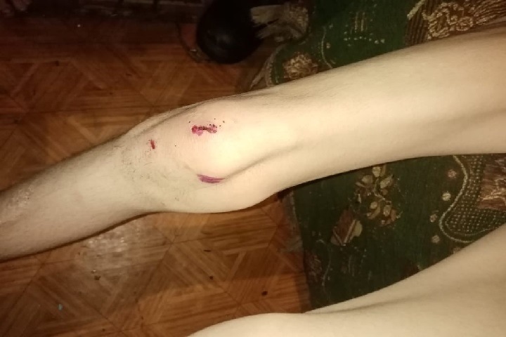 Уголовное дело завели после истязаний воспитанника в новосибирском интернате