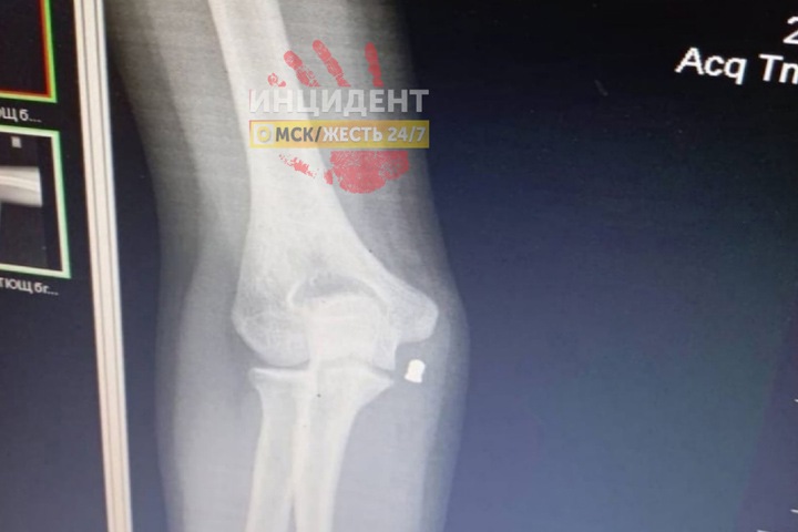 Неизвестный обстрелял трех девочек в Омске Неизвестный обстрелял трех девочек в Омске