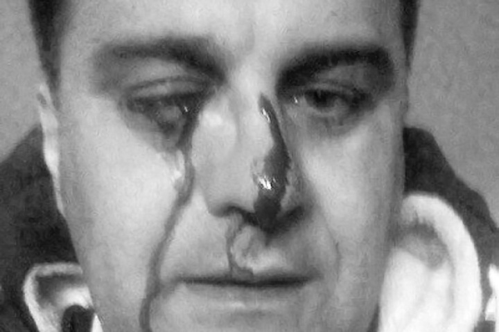 Новосибирского депутата от «ЕР» осудили за избиение главы сельсовета, обвиненного в коррупции