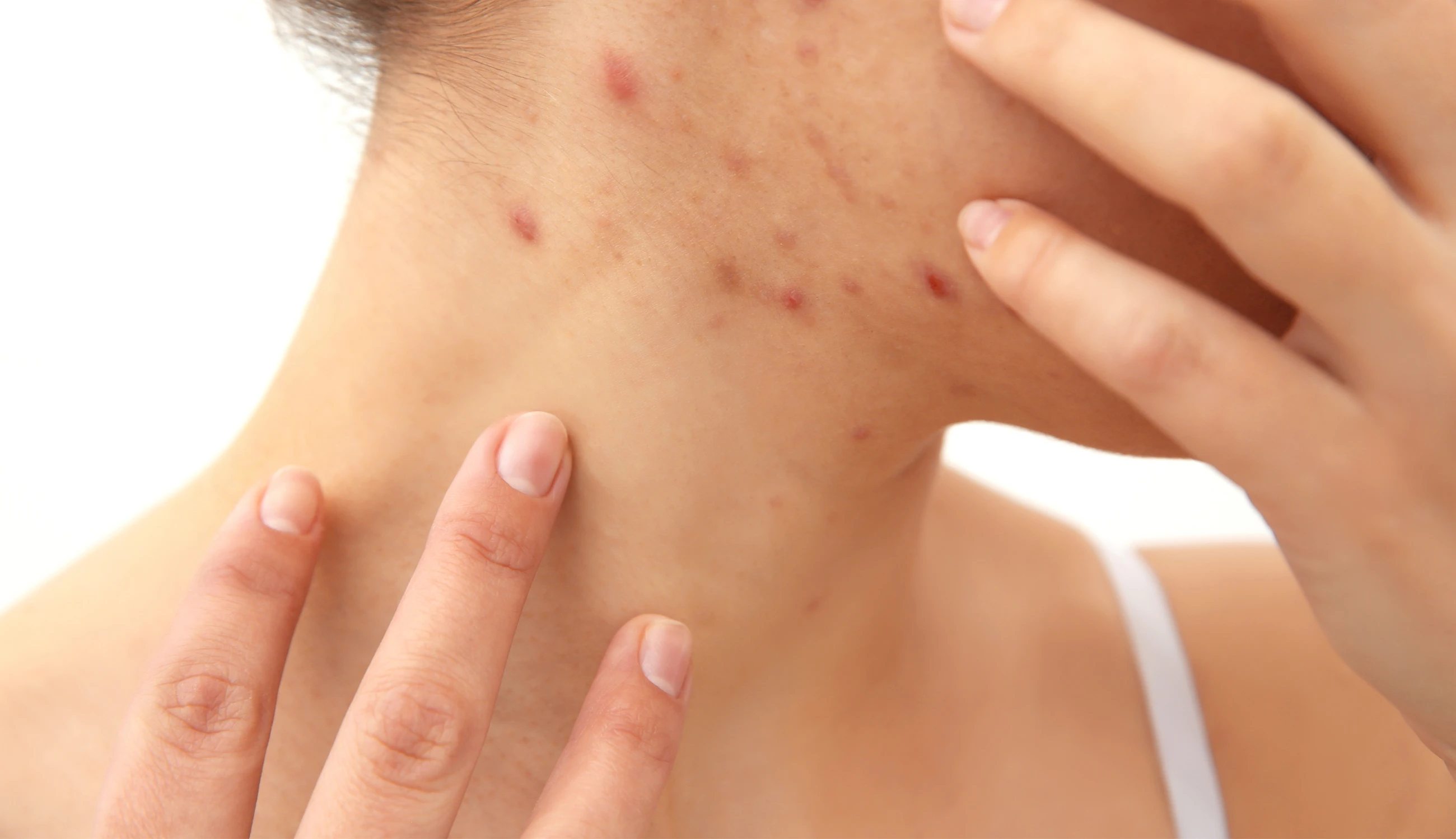 признаки кожного заболевания