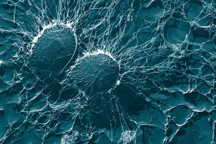 Российские разработчики создали сервис для анализа микробиома кишечника. Он свяжет образ жизни со здоровьем
