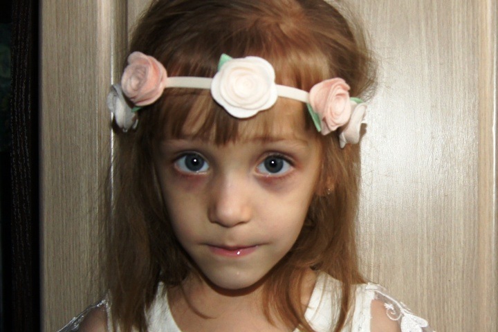 Пятилетней сибирячке необходимо дорогое лечение в Москве