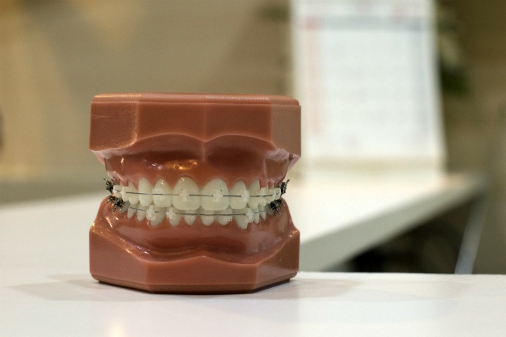 Российские исследователи научились предсказывать развитие кариеса Российские исследователи научились предсказывать развитие кариеса