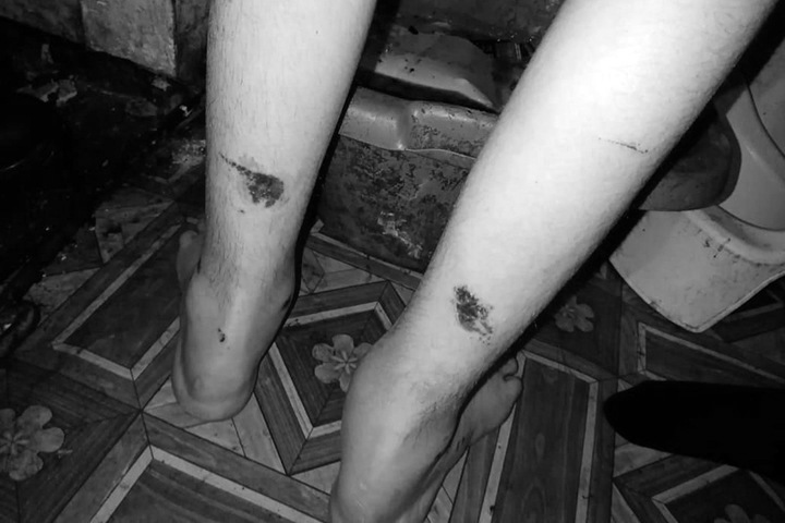 Чиновники отрицают нарушения в новосибирском интернате, где заявляли об истязаниях