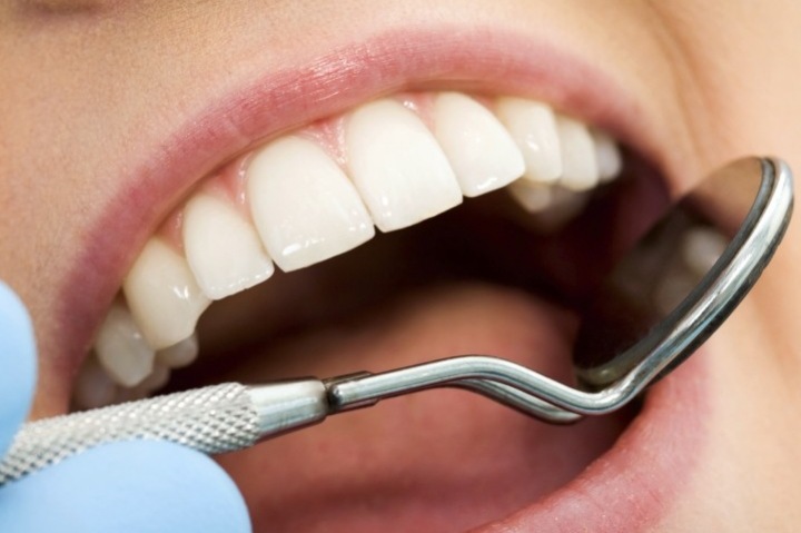 Верните себе красоту и здоровье, посетите стоматолога Верните себе красоту и здоровье, посетите стоматолога