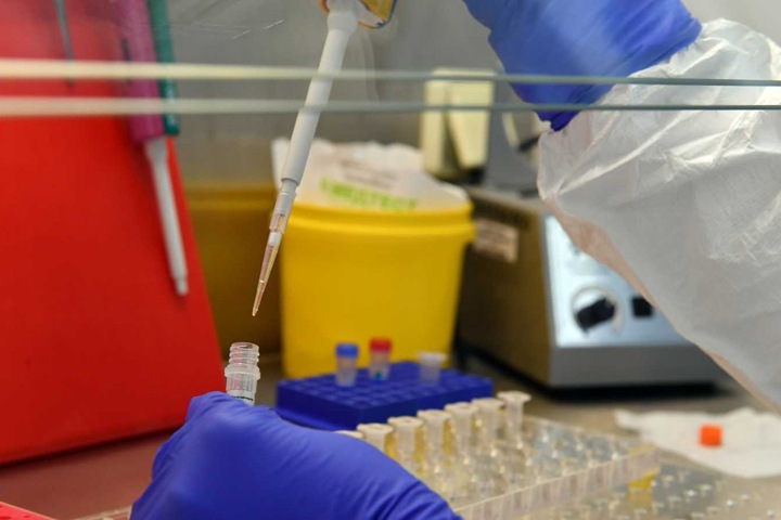 Путин объявил о регистрации первой вакцины от коронавируса, несмотря на сомнения экспертов