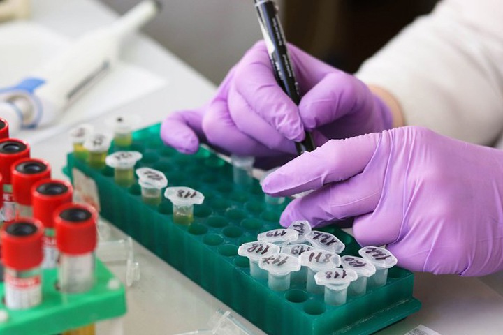 Лаборатории столкнулись с дефицитом реагентов для анализов