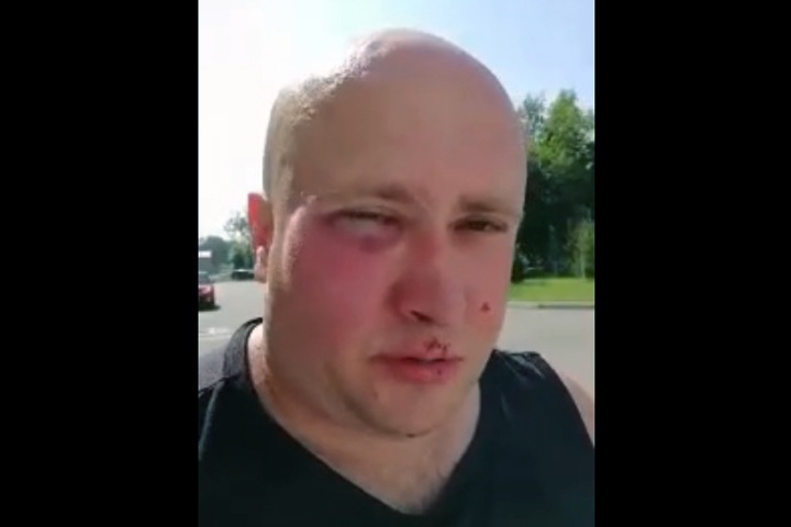 Красноярские тюремщики списали травмы обвинившего их в избиении заключенного на падение с носилок