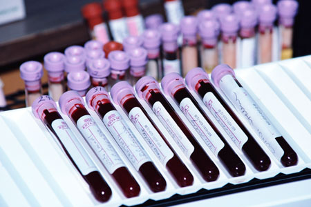 Кемеровская область стала лидером в России по распространению ВИЧ Кемеровская область стала лидером в России по распространению ВИЧ