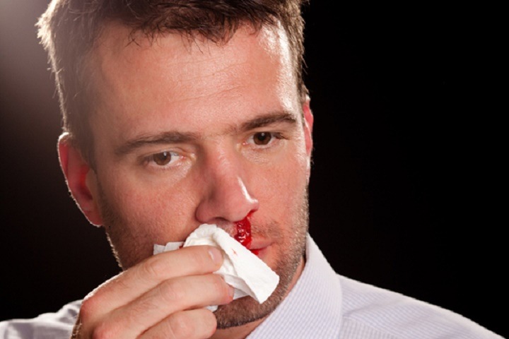 Омич откусил знакомому нос во время драки