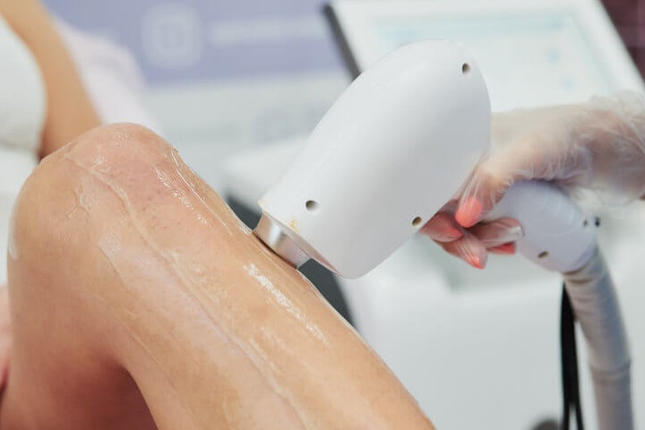 Лазерная эпиляция, особенности процедуры и подготовки к ней Лазерная эпиляция, особенности процедуры и подготовки к ней