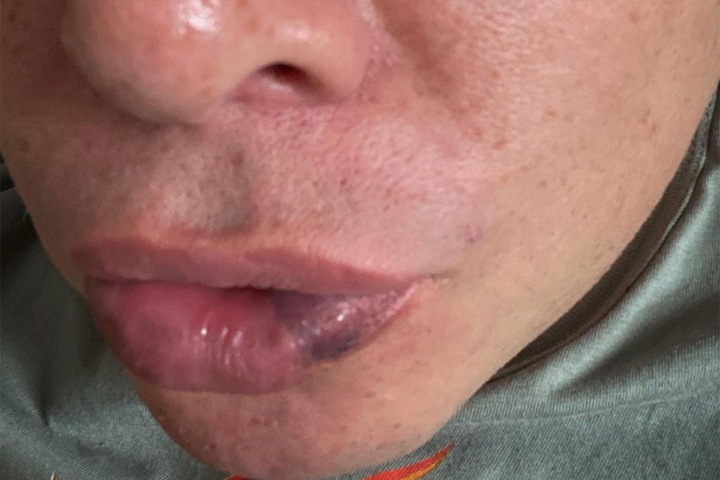 Красноярский педиатр заявил об избиении за критику псевдоврачей в инстаграме Красноярский педиатр заявил об избиении за критику псевдоврачей в инстаграме