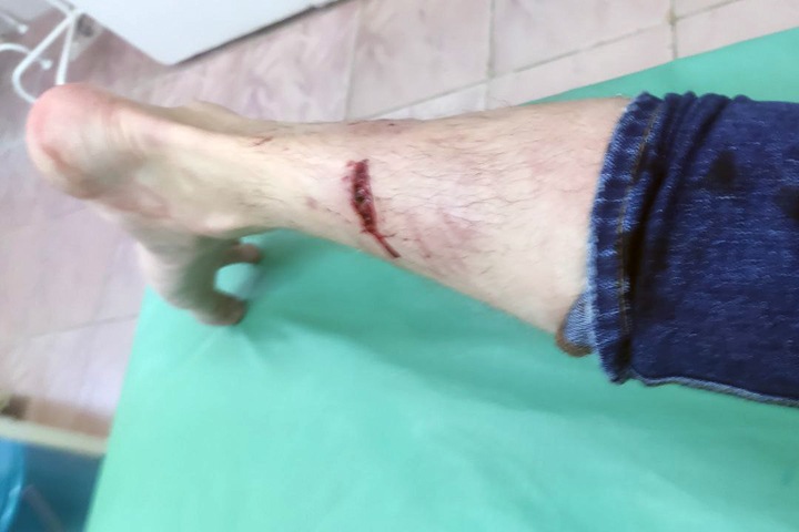 Бездомные собаки напали на депутата гордумы Томска Бездомные собаки напали на депутата гордумы Томска