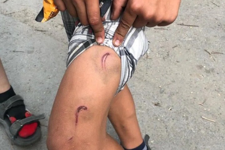 Семилетнего новосибирца изъяли из семьи после побоев отчима Семилетнего новосибирца изъяли из семьи после побоев отчима