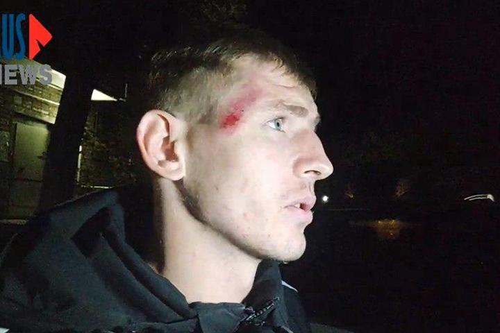 Неизвестные похитили и избили освещавшего протесты журналиста из Хабаровска Неизвестные похитили и избили освещавшего протесты журналиста из Хабаровска