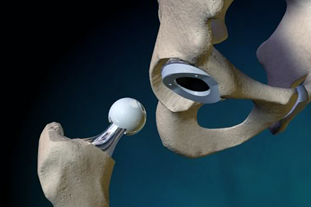 Власти одобрили займ на первый новосибирский проект импортозамещения