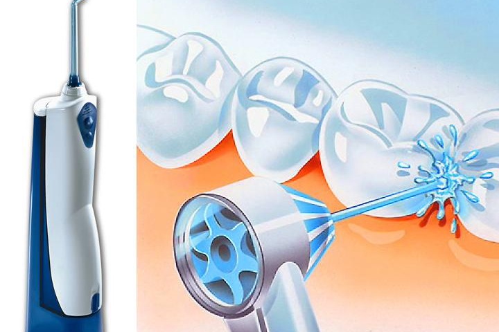 Ирригаторы для зубов и полости рта – особенности Ирригаторы для зубов и полости рта – особенности