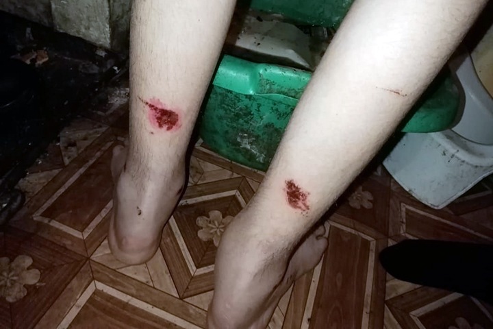 Омбудсмен начал проверку заявления об истязаниях в новосибирском интернате Омбудсмен начал проверку заявления об истязаниях в новосибирском интернате