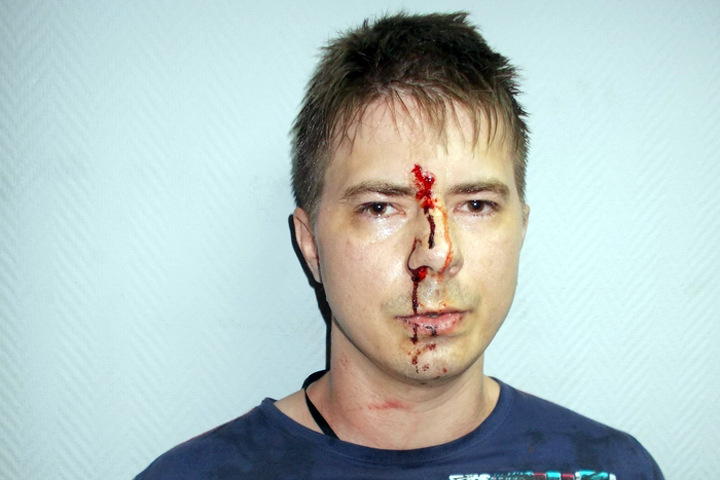 Суд над избитым полицейскими блогером начался в Кемерове