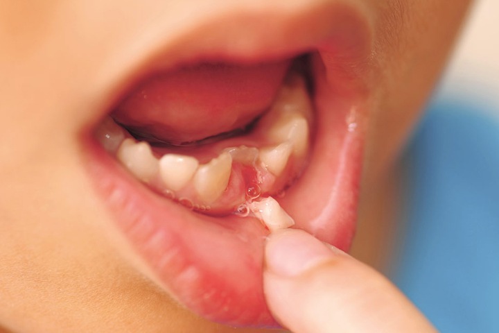 Пятилетний ребенок скончался после удаления зубов в Томской области Пятилетний ребенок скончался после удаления зубов в Томской области