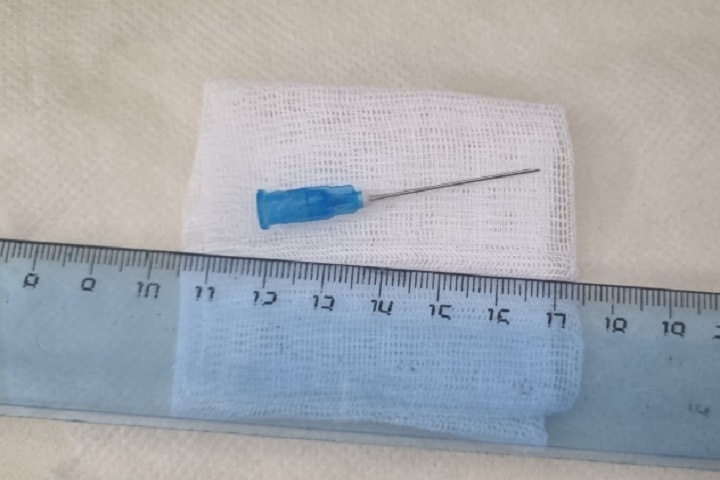 Иркутский подросток вдохнул иглу от шприца для инъекций