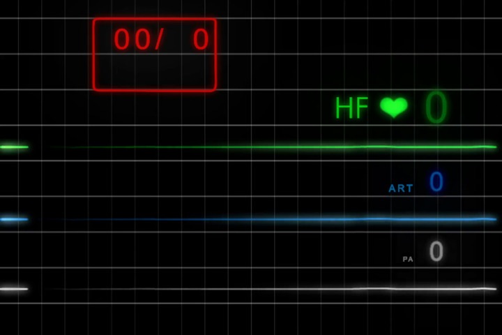 Третий пациент с коронавирусом скончался в Новосибирске Третий пациент с коронавирусом скончался в Новосибирске