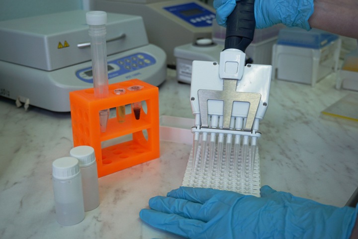 Сибирские ученые нашли простой способ выявления рассеянного склероза