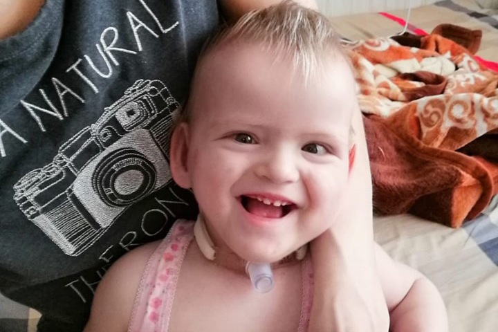 Девочке из Новосибирска требуется специальное оборудование, чтобы дышать