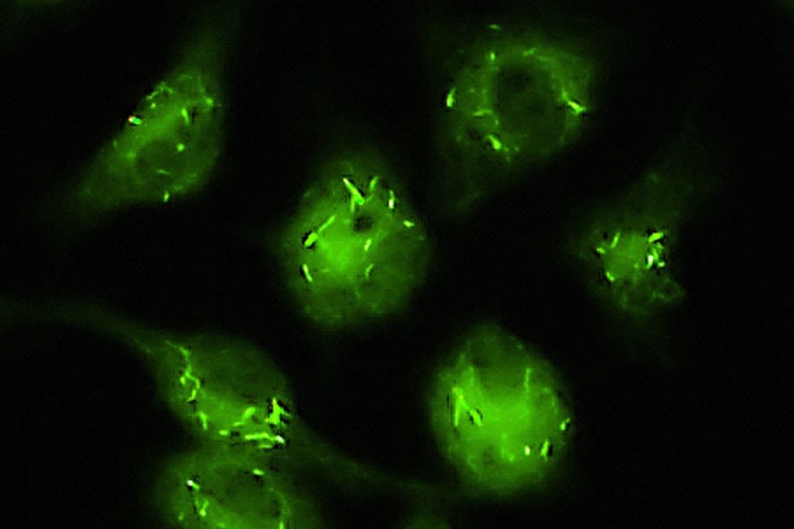 Сибирские ученые создали лекарство от туберкулеза без побочных эффектов Сибирские ученые создали лекарство от туберкулеза без побочных эффектов
