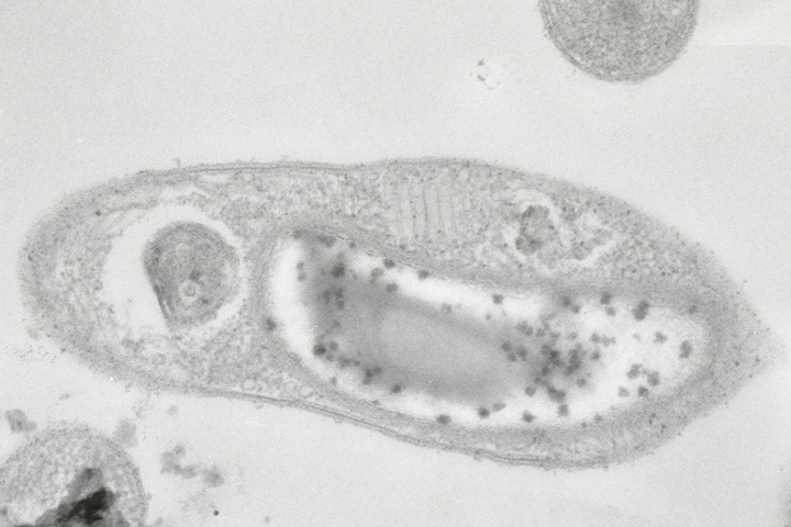 Томские ученые впервые выделили бактерию, способную выжить в космосе Томские ученые впервые выделили бактерию, способную выжить в космосе