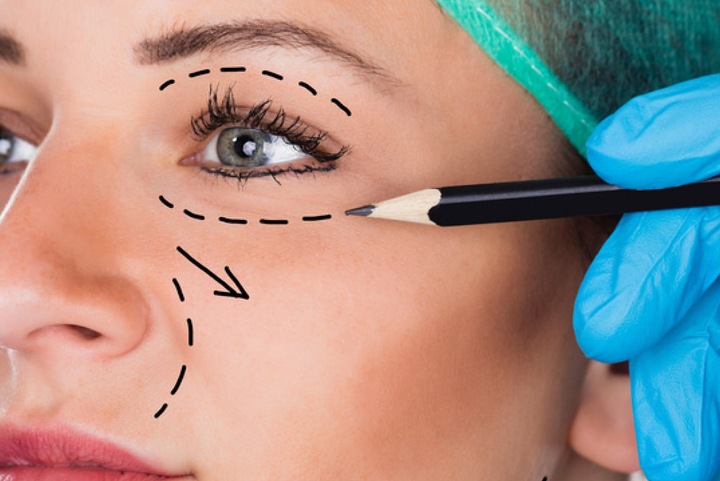 Пластика лица и не только – профессионально в Эстет Клиник Пластика лица и не только – профессионально в Эстет Клиник