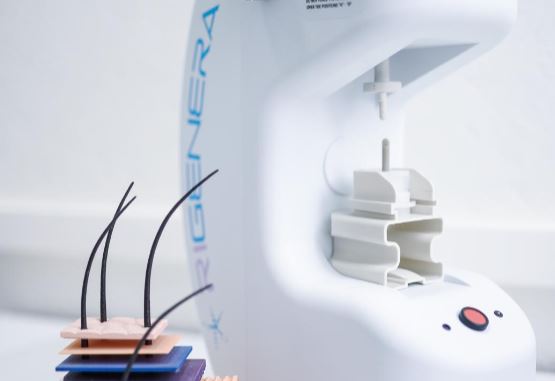 андрогенная алопеция