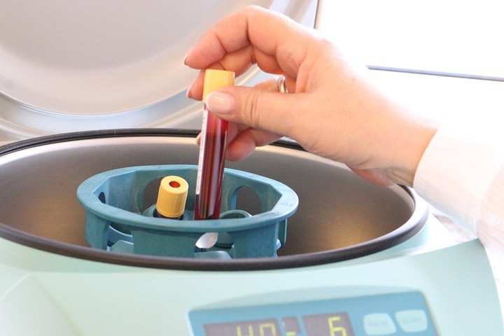 Сибирские ученые придумали, как определить шизофрению по анализу крови Сибирские ученые придумали, как определить шизофрению по анализу крови