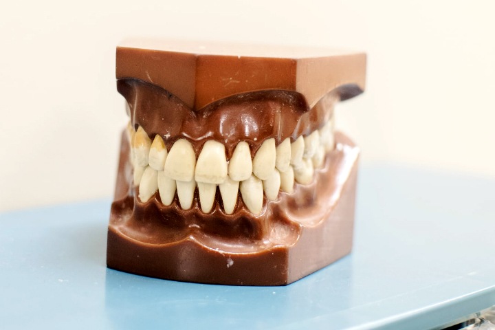 Российские ученые нашли способ выращивать зубную ткань у людей