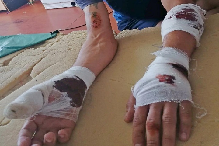 Ротвейлер изгрыз руки ассенизатору в Новосибирске