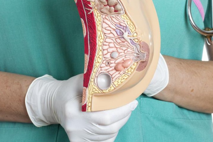 Эффективный способ диагностики здоровья молочной железы