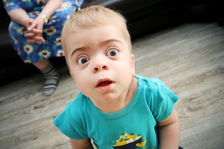 «Нам не до философии, мы спасаем сына»: как выжить ребенку с мукополисахаридозом в Новосибирске «Нам не до философии, мы спасаем сына»: как выжить ребенку с мукополисахаридозом в Новосибирске